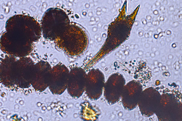 Mixoplankton Thumbnail